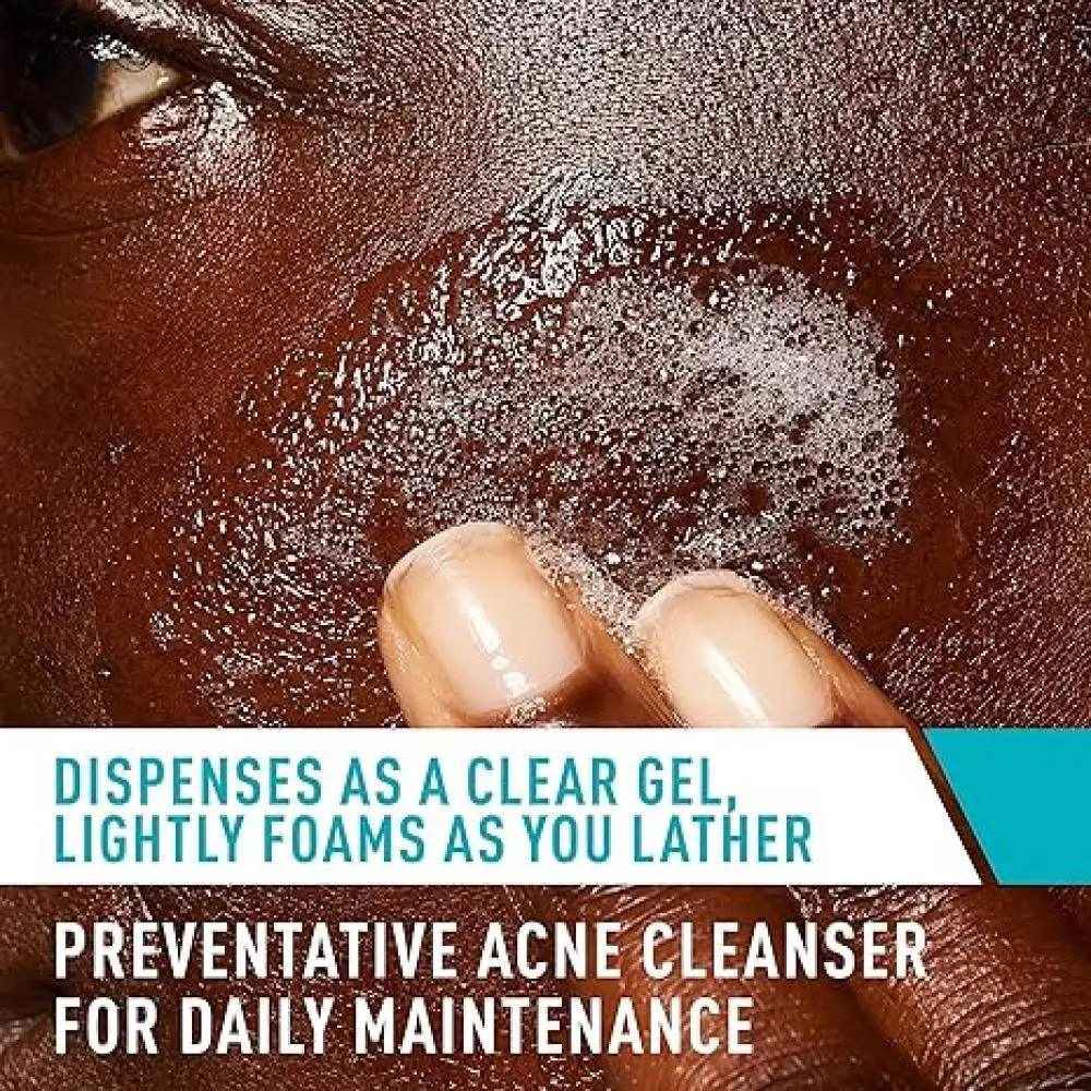 Cerave Acne Control Cleanser - 3