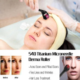 Derma Roller Systems, Derma microneedle roller for face and body, 1.0 mm, 540 titanium micro needles, Storage case included - 4 miniature