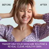 BEAUME® Highly Concentrated Niacinamide + Zinc Serum with 10% Niacinamide, 1% Zinc and Hyaluronic Acid, 30ml - 8 miniature