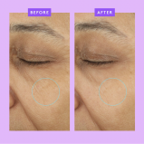 Drunk Elephant Ceramighty AF Eye Balm - 3 miniature