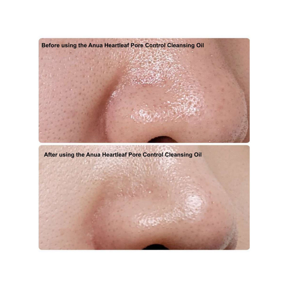 Anua, Heartleaf Pore Control Cleansing Oil Mini - 2