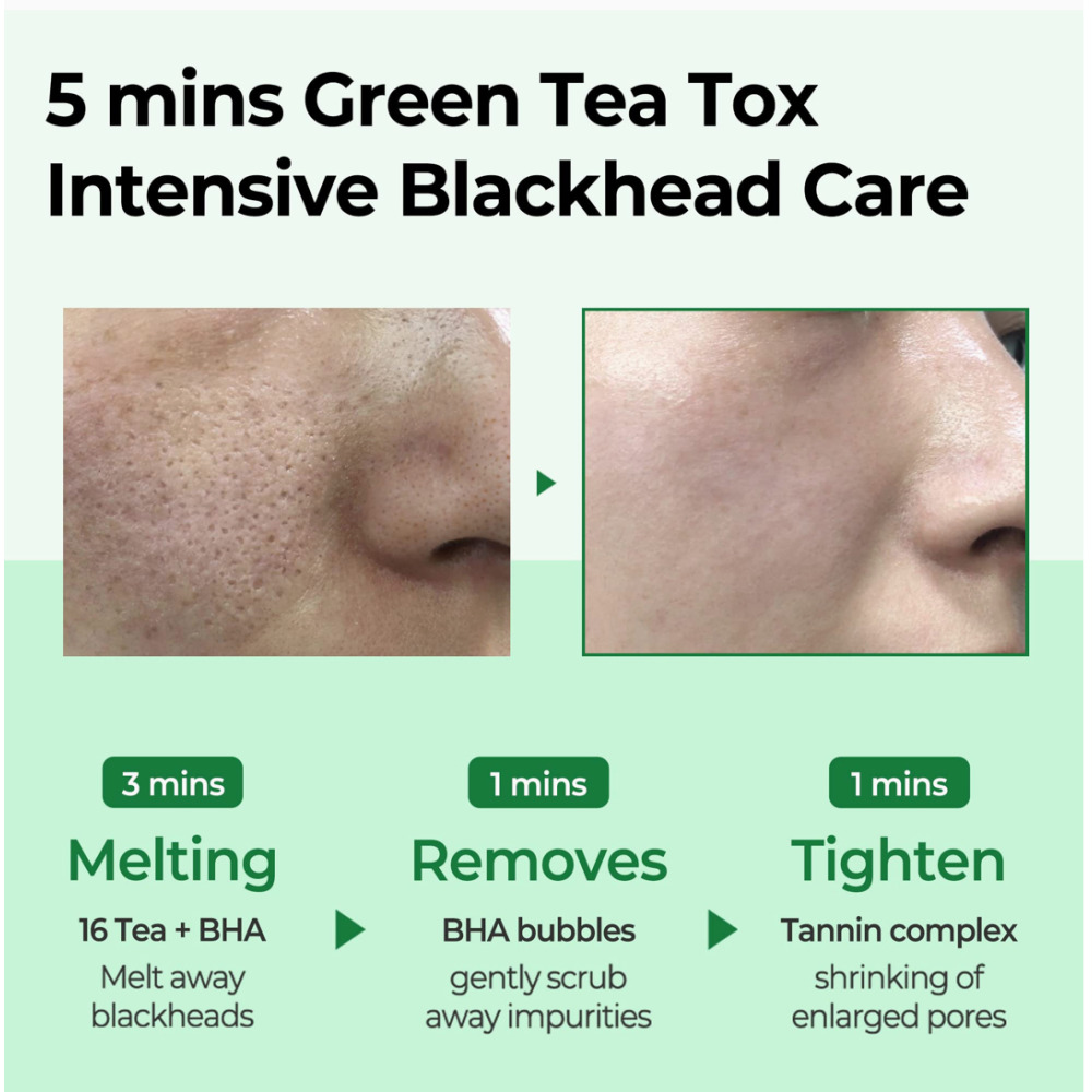 Bye Bye Blackhead Some By Mi - 3