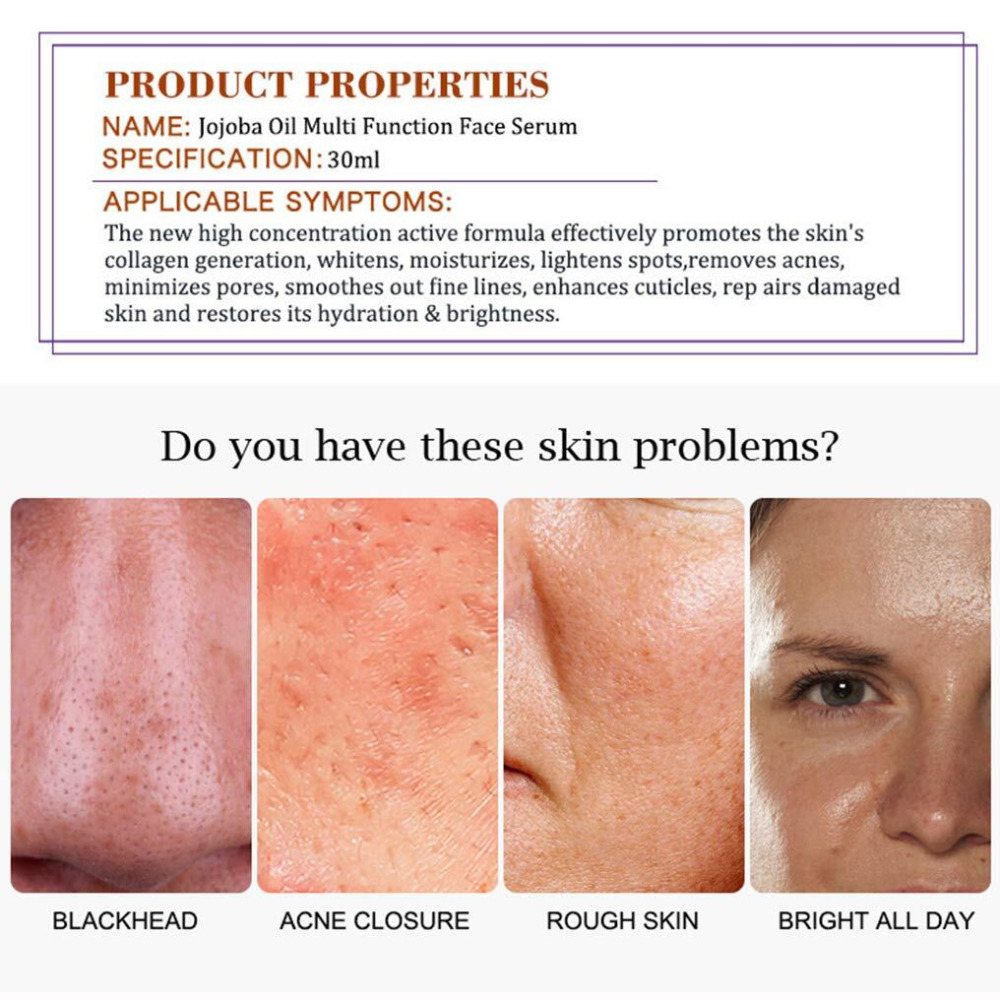 Aichun Beauty Сыворотка Для Лица Аргановое Касторовое Масло Жожоба С Маслом Чайного ДЕРЕВА многофункциональная 30 мл - 3