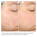 The Ordinary Exfoliating Salicylic Acid 2% Solution 30ml - 3 miniature