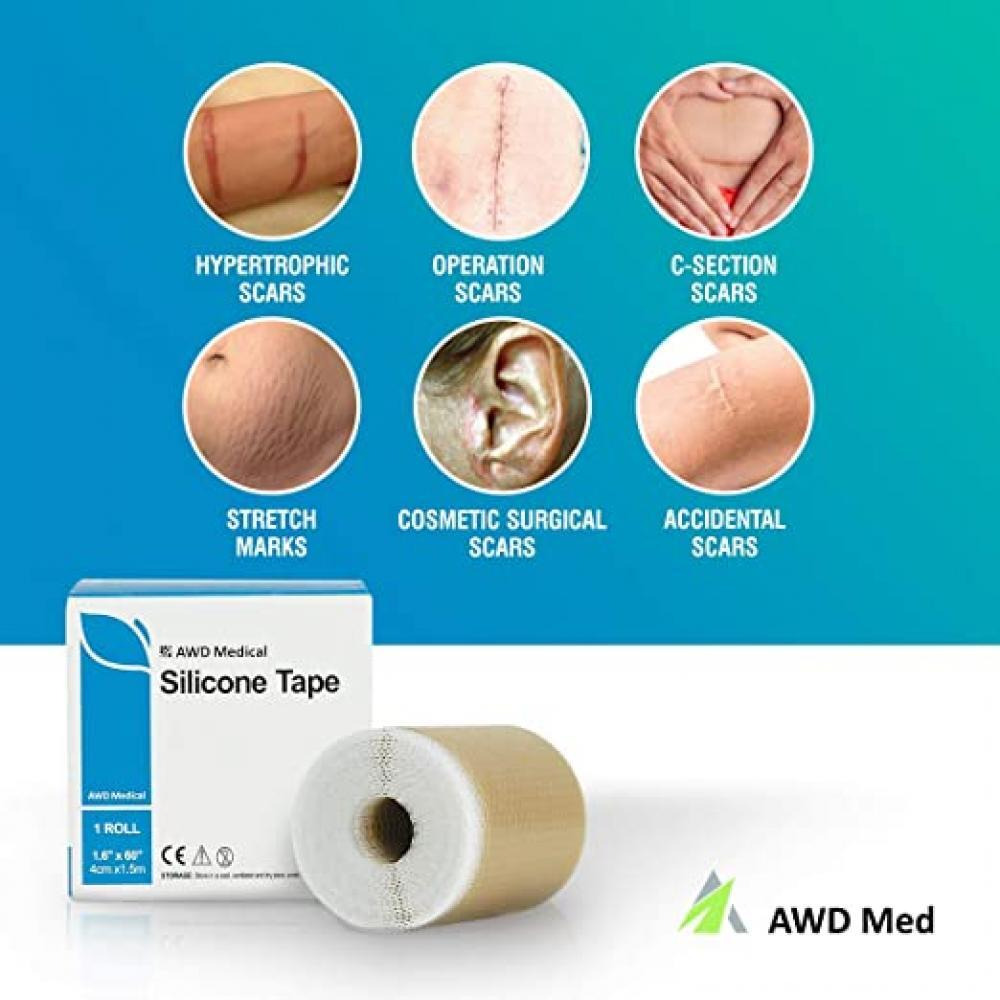 AWD Medical / Medical silicone scar sheets, 1x150 cm - 3