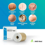 AWD Medical / Medical silicone scar sheets, 1x150 cm - 3 miniature