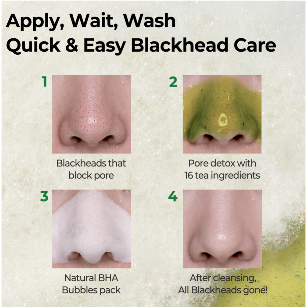 Bye Bye Blackhead Some By Mi - 4